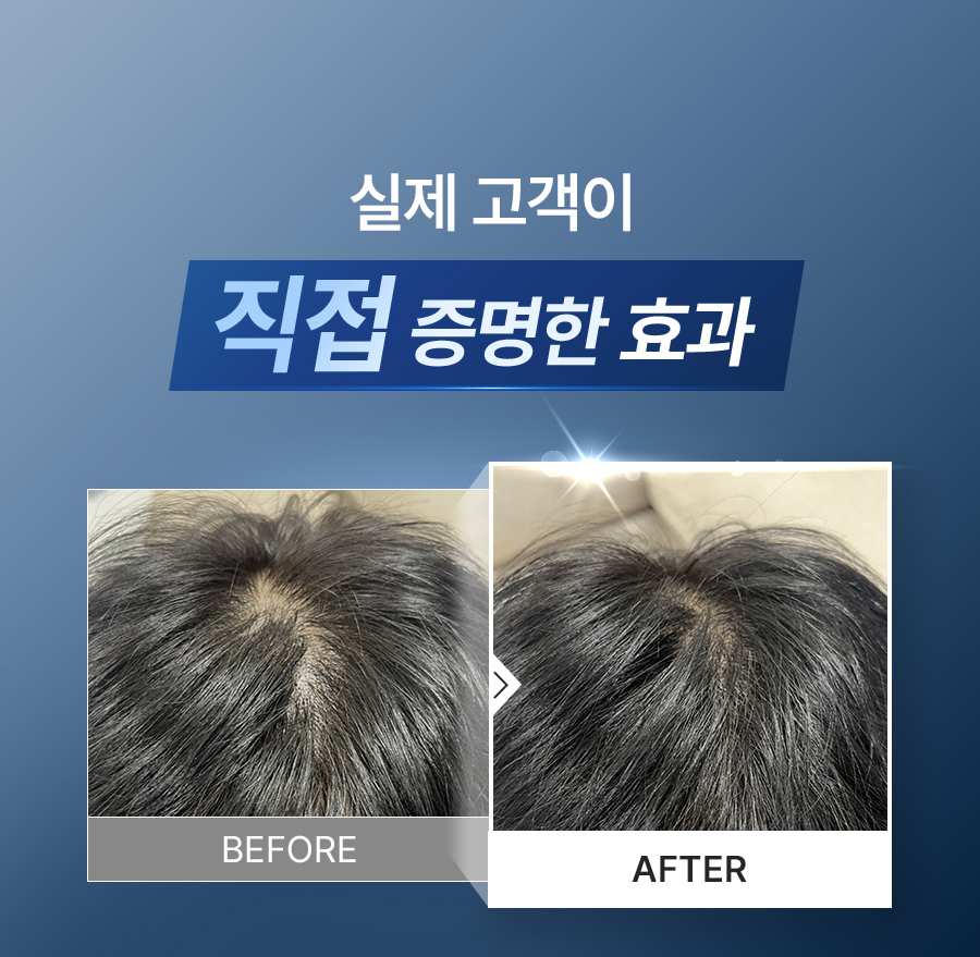 EPAIS Scalp Boosting Ampoule EX - description 3